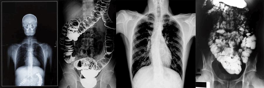 Doctor Muhletaler Radiological Xray 1