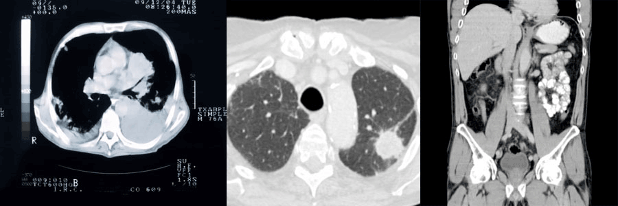 Doctor Muhletaler Radiological Xray 2