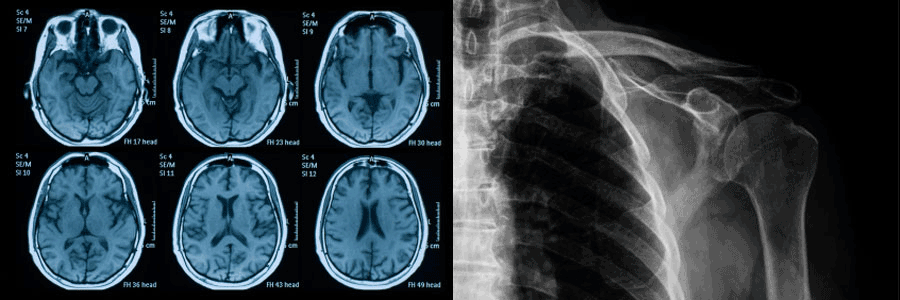 Doctor Muhletaler Radiological Xray 6