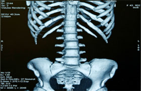 X-ray image 1